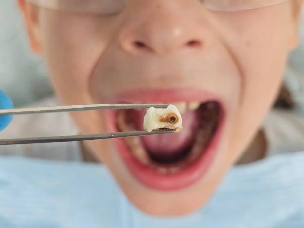 Best Pediatric Emergency Dentist in Buffalo Grove, IL
