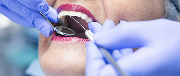 Best Mobile Emergency Dentist in Buffalo Grove, IL